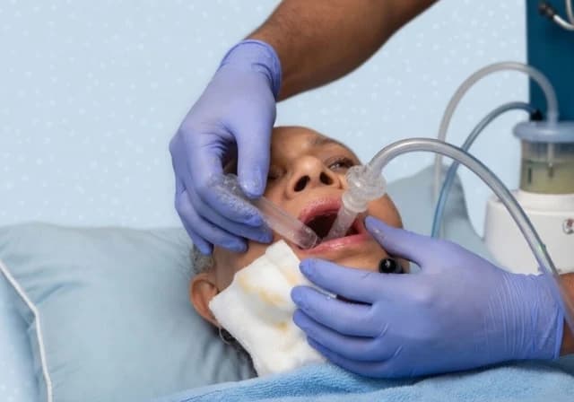 Oral Suction at Home